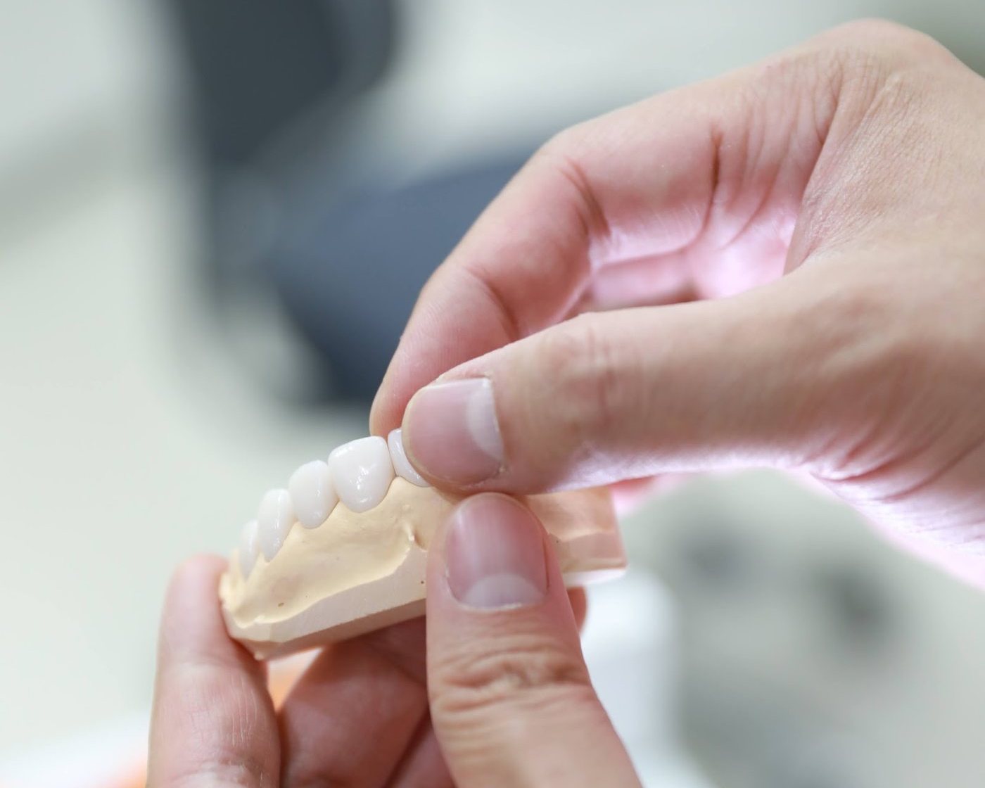 The designed veneers are checked on a model for length, edge line and thickness first.