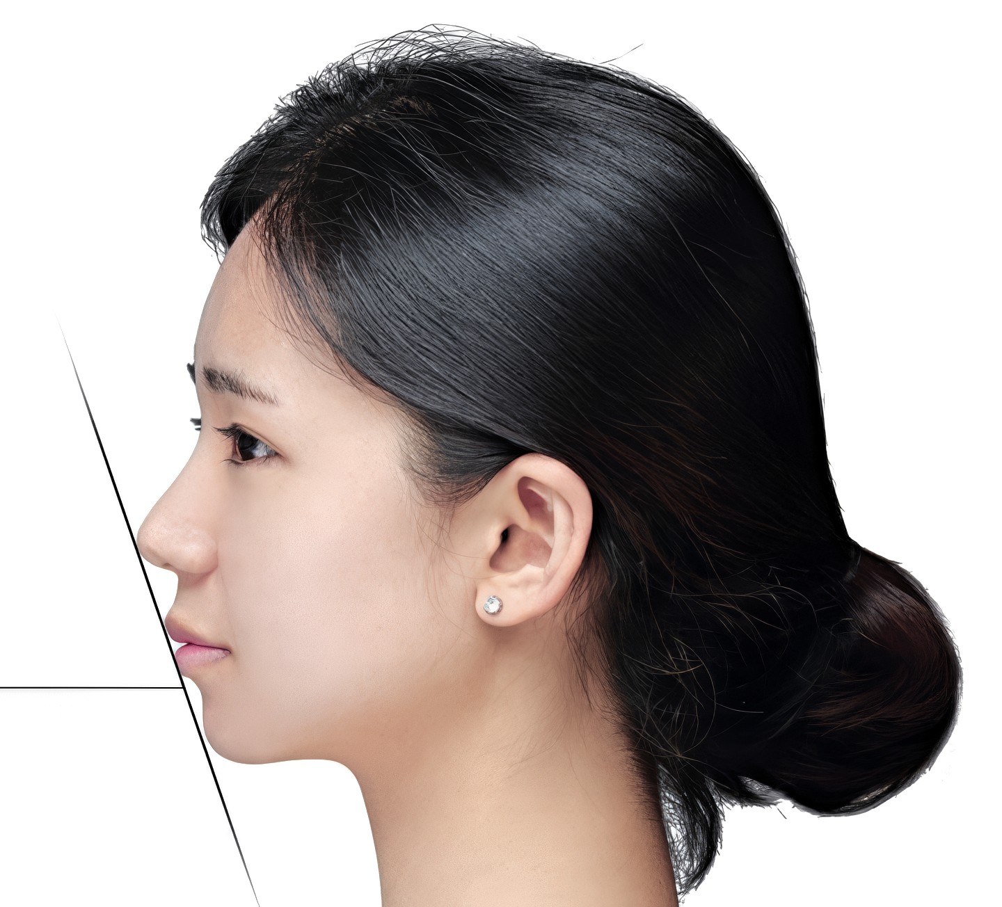 Model photo showing E-Line profile diagnosis