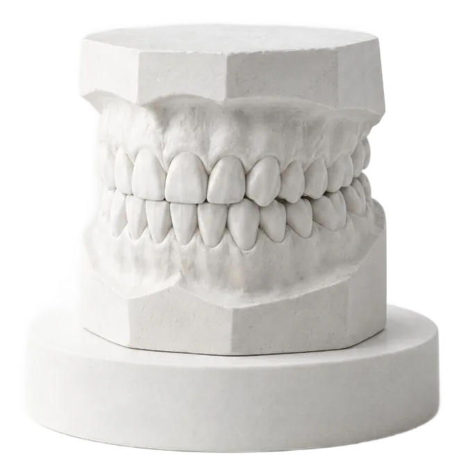 Plaster dental model sculpture (staged image)