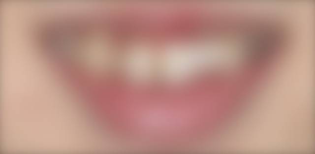 施術前の写真(ぼかし処理、ログイン後にご覧いただけます)