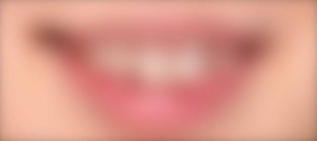 施術前の写真(ぼかし処理、ログイン後にご覧いただけます)