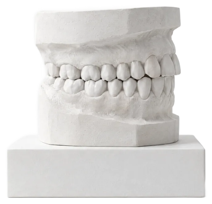 Side view of a plaster model with the upper and lower teeth together