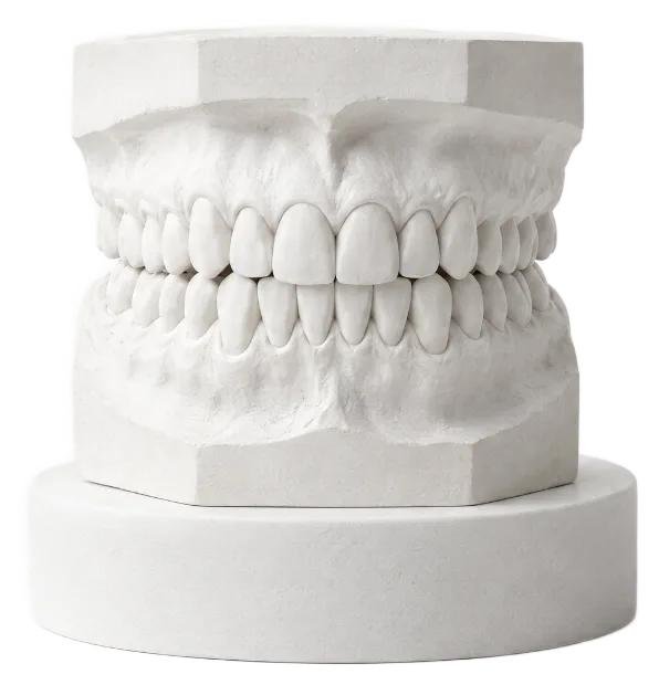 Front view of a plaster model with the upper and lower teeth together
