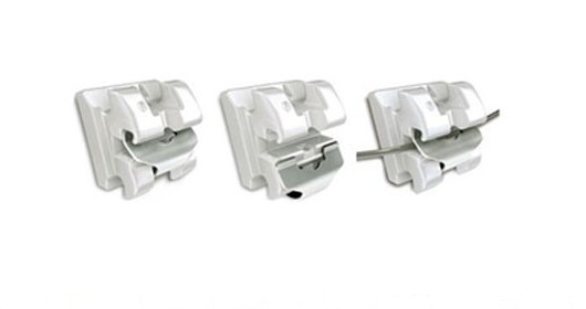 Clippy-C self-ligating bracket