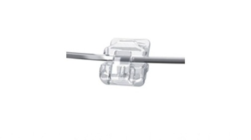 Damon Clear self-ligating bracket