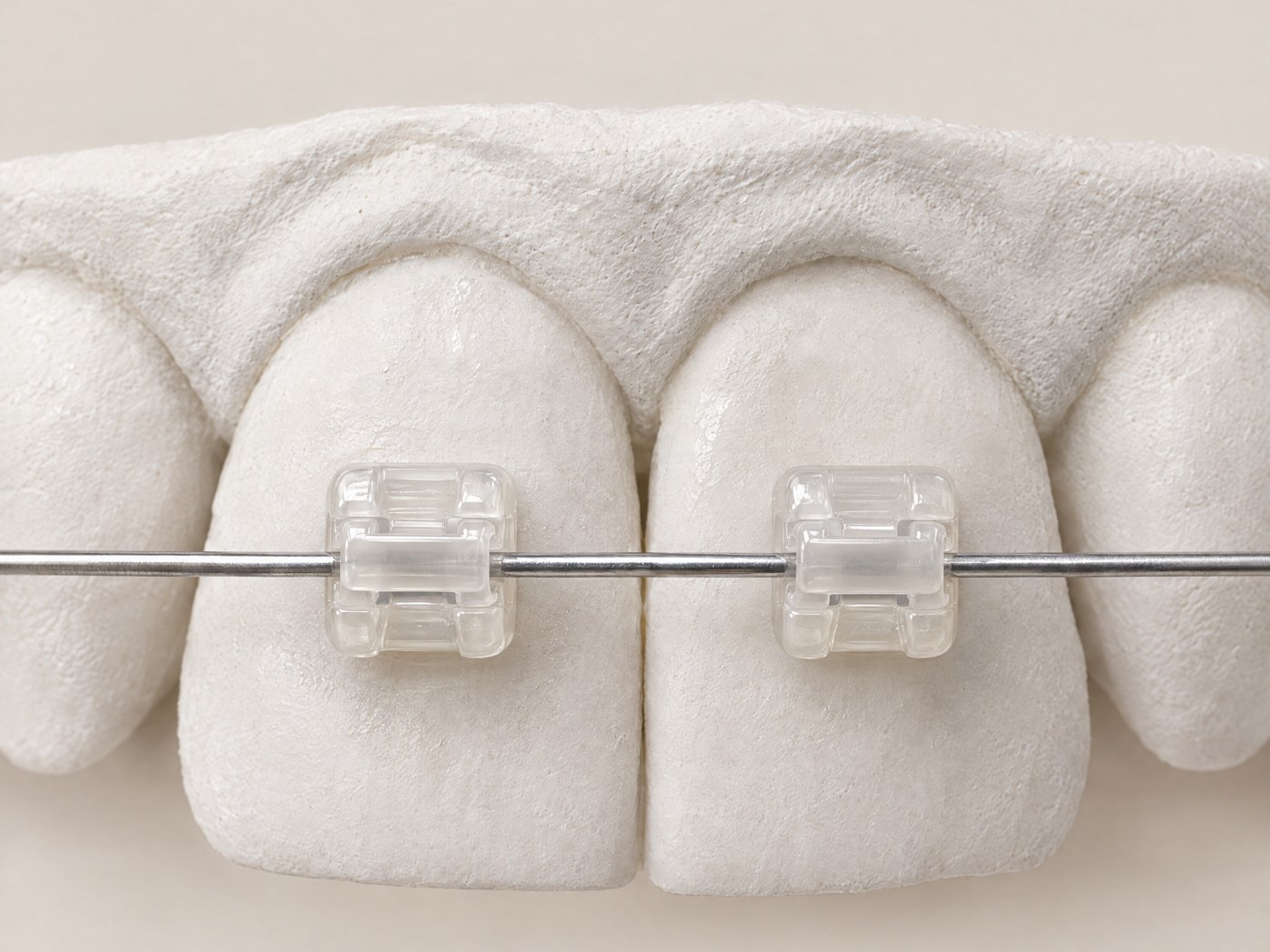 Self-ligation bracket