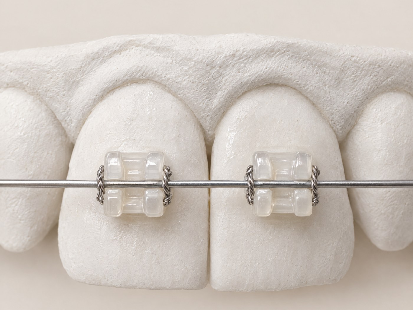 Wire ligation bracket